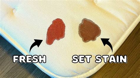 how to get dried blood out of fabric